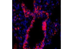 Immunofluorescent analysis of paraformaldehyde-fixed rat lung using,CD63 (ABIN7073400) at dilution of 1: 1500 (CD63 抗体)