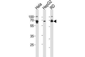 Western Blotting (WB) image for anti-Protein Kinase, AMP-Activated, gamma 3 Non-Catalytic Subunit (PRKAG3) antibody (ABIN2999063) (PRKAG3 抗体)