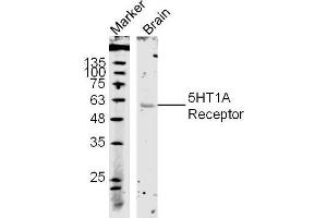 Western Blotting (WB) image for anti-Serotonin Receptor 1A (HTR1A) (AA 301-400) antibody (ABIN738006)