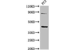 Western Blot Positive WB detected in: PC-3 whole cell lysate All lanes: TNFRSF19 antibody at 2. (TNFRSF19 抗体  (AA 276-415))