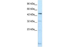 DMRTA2 antibody used at 0. (DMRTA2 抗体  (C-Term))