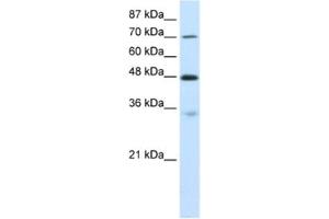 Western Blotting (WB) image for anti-Cysteinyl-tRNA Synthetase (CARS) antibody (ABIN2462085) (CARS 抗体)