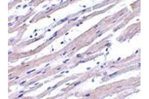 Immunohistochemistry of Apaf1 in human heart tissue with Apaf1 antibody at 1 μg/ml. (APAF1 抗体  (N-Term))