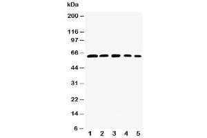Western blot testing of RelB antibody and Lane 1:  rat testis