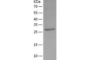 Western Blotting (WB) image for Zinc Finger Protein 418 (ZNF418) (AA 124-416) protein (His tag) (ABIN7125791) (ZNF418 Protein (AA 124-416) (His tag))