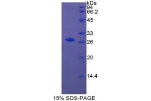 SDS-PAGE of Protein Standard from the Kit (Highly purified E.
