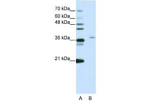 WB Suggested Anti-SART3 Antibody Titration:  2. (SART3 抗体  (N-Term))