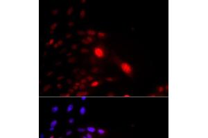 Immunofluorescence analysis of U2OS cells using DDB2 Polyclonal Antibody (DDB2 抗体)