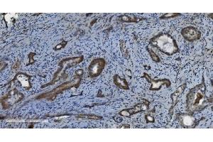 IHC analysis of PARP using anti-PARP antibody (ABIN7602277). (PARP1 抗体  (AA 670-858))