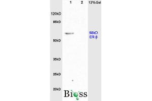 L1 rat brain, L2 rat colon lysates probed (ABIN725855) at 1:200 in 4 °C. (Estrogen Receptor alpha + beta (AA 201-300) 抗体)