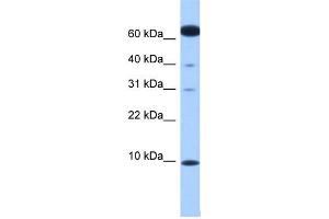 Western Blotting (WB) image for anti-Dynein, Light Chain, LC8-Type 2 (DYNLL2) (N-Term) antibody (ABIN2784960)