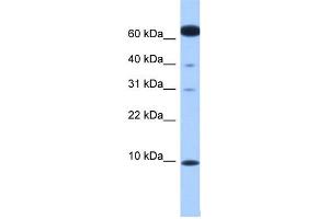 WB Suggested Anti-DYNLL2 Antibody Titration: 0. (DYNLL2 抗体  (N-Term))