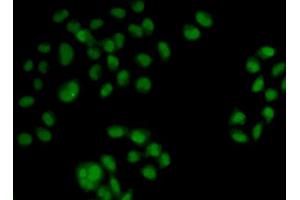 Immunofluorescence analysis of HeLa cells using OAS1 antibody (ABIN5971361). (OAS1 抗体)