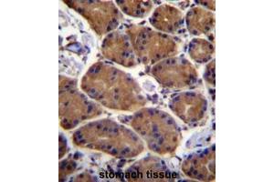 ASPH Antibody (Center) immunohistochemistry analysis in formalin fixed and paraffin embedded human stomach tissue followed by peroxidase conjugation of the secondary antibody and DAB staining. (Aspartate beta Hydroxylase 抗体  (Middle Region))