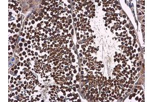 Immunohistochemistry (IHC) image for anti-Prostaglandin E Synthase 3 (Cytosolic) (PTGES3) antibody (ABIN2856401)