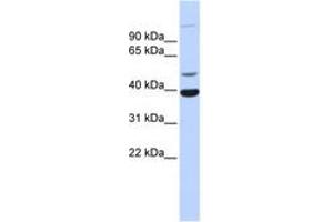 Image no. 1 for anti-Zinc Finger Protein 124 (ZNF124) (AA 179-228) antibody (ABIN6742594) (ZNF124 抗体  (AA 179-228))