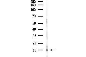 anti-Hairy and Enhancer of Split 3 (HES3) (N-Term) antibody