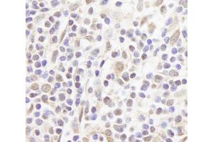 Immunohistochemistry (IHC) image for anti-Zinc Finger Protein, Multitype 1 (ZFPM1) (AA 175-225) antibody (ABIN7448567)