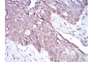 Fig. (PKHD1 抗体  (AA 3878-4060))