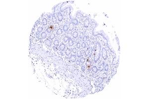 Duodenum mucosa Intense somatostatin staining of scattered neuroendocrine delta cells (Recombinant Somatostatin 抗体)