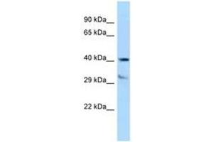Image no. 1 for anti-Tocopherol (Alpha) Transfer Protein (TTPA) (AA 204-253) antibody (ABIN6747970) (TTPA 抗体  (AA 204-253))