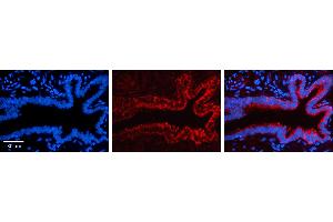 Immunohistochemistry (IHC) image for anti-Lysyl-tRNA Synthetase (KARS) (C-Term) antibody (ABIN2778941)