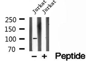 Western blot analysis of extracts of Jurkat cells, using OTUD7B antibody. (OTUD7B 抗体  (C-Term))
