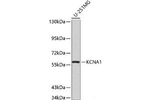 Western blot analysis of extracts of U-251MG cells using KCNA1 Polyclonal Antibody. (KCNA1 抗体)