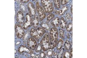 Immunohistochemical staining of human kidney with FAM171B polyclonal antibody  shows strong cytoplasmic positivity in cells in tubules at 1:50-1:200 dilution. (FAM171B 抗体)