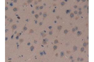 Immunohistochemistry (IHC) image for anti-DKK3 (AA 23-349) antibody (ABIN7443053)