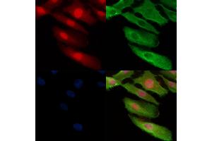 Phospho-TMS1/ASC (Ser195) Antibody staining A549 cells(H2O2 treatment) by IF/ICC. (PYCARD 抗体  (pSer195))