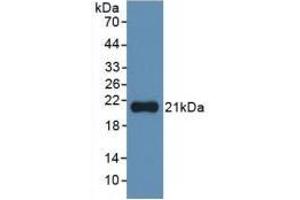Detection of Recombinant IL1a, Human using Monoclonal Antibody to Interleukin 1 Alpha (IL1a) (IL1A 抗体  (AA 113-271))