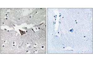 Immunohistochemistry analysis of paraffin-embedded human brain tissue, using FAK (Ab-925) Antibody. (FAK 抗体  (AA 892-941))