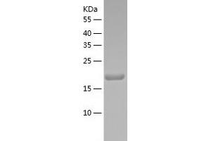 Western Blotting (WB) image for Metadherin (MTDH) (AA 271-456) protein (His tag) (ABIN7287795) (MTDH Protein (AA 271-456) (His tag))