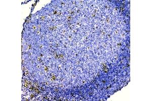 IHC analysis of ZEB2 using anti-ZEB2 antibody (ABIN3042325).