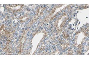 ABIN6276905 at 1/100 staining Human prostate tissue by IHC-P. (IL2RG 抗体  (N-Term))