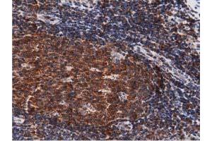 Image no. 7 for anti-DnaJ (Hsp40) Homolog, Subfamily A, Member 2 (DNAJA2) antibody (ABIN1497858)