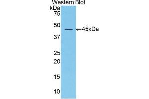 Western Blotting (WB) image for anti-serpin Peptidase Inhibitor, Clade A (Alpha-1 Antiproteinase, Antitrypsin), Member 1 (SERPINA1) (AA 25-413) antibody (ABIN7429055)