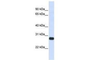 Image no. 1 for anti-serine Peptidase Inhibitor, Kunitz Type, 2 (SPINT2) (AA 180-229) antibody (ABIN6741061) (SPINT2 抗体  (AA 180-229))