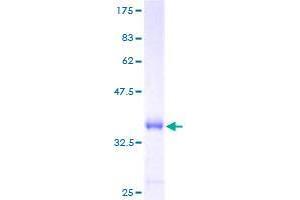 BRK1 Protein (AA 1-75) (GST tag)