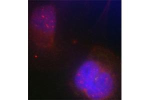 Immunofluorescence staining of methanol-fixed Hela cells using Phospho-BRCA1-S988 antibody. (BRCA1 抗体  (pSer988))