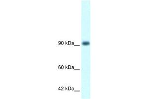 WB Suggested Anti-RBM10 Antibody Titration:  1. (RBM10 抗体  (N-Term))