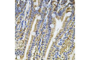 Immunohistochemistry of paraffin-embedded mouse intestine using NFU1 Antibody (ABIN5975479) at dilution of 1/100 (40x lens). (NFU1 抗体)