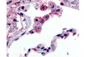 Anti-GPR43 antibody IHC of human lung, alveolar macrophages. (FFAR2 抗体  (C-Term))