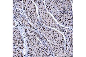 IHC analysis of MBNL1 using anti-MBNL1 antibody (ABIN7602608).