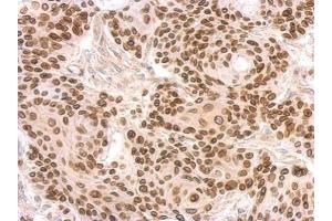 IHC-P Image Lamin B2 antibody [N3C2], Internal detects LMNB2 protein at on Cal27 xenograft by immunohistochemical analysis. (Lamin B2 抗体)
