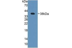 Detection of Recombinant PIIINP, Human using Polyclonal Antibody to Procollagen III N-Terminal Propeptide (PIIINP) (PIIINP 抗体)