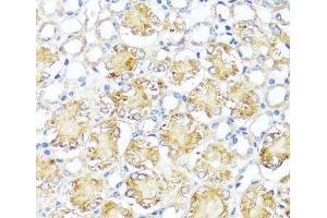 Immunohistochemistry of paraffin-embedded Mouse kidney using MAS1 Polyclonal Antibody at dilution of 1:100 (40x lens). (MAS1 抗体)