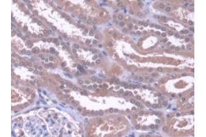 DAB staining on IHC-P; Samples: Human Kidney Tissue (ZNF10 抗体  (AA 1-244))