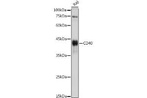 Western blot analysis of extracts of Raji cells, using CD40 antibody (ABIN3020703, ABIN3020704, ABIN3020705 and ABIN6213680) at 1:1000 dilution. (CD40 抗体)